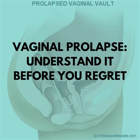 cervix prolapse porn